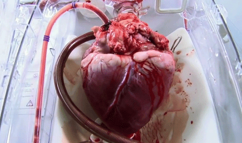 Heart Heart